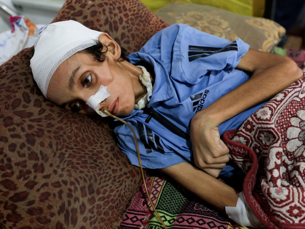 Aid groups warn of ‘mass starvation’ in Gaza | Israel-Palestine conflict News
