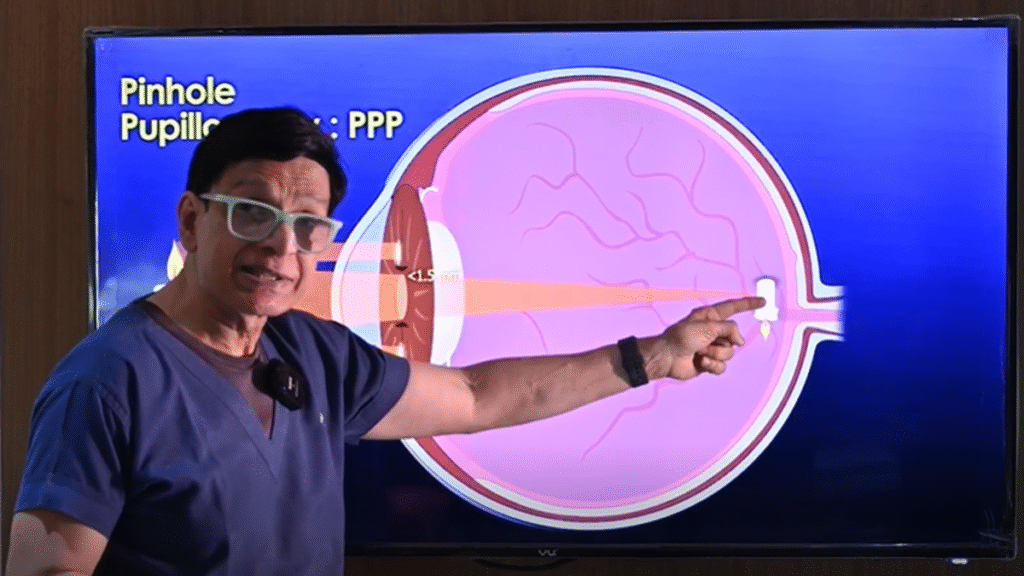Hole in one: Pinhole pupilloplasty emerges as alternative to corneal transplants