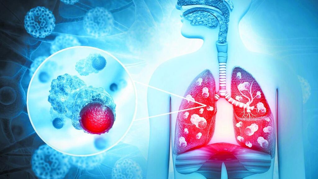 ICMR-NIE study calls for year-round monitoring of respiratory infections
