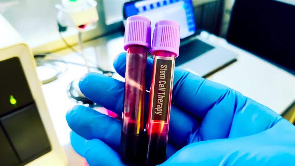 Stem Cell Therapy for liver failure shows success in animal trials: Hyderabad-Based Startup