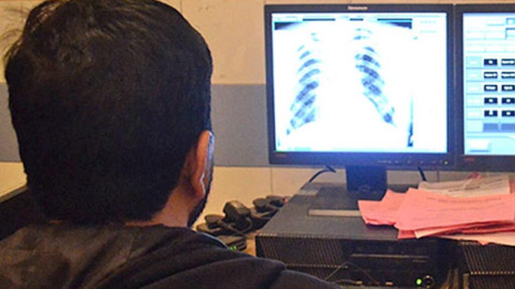 ICMR study shows improved nutrition's impact in curbing TB; WHO recognises it