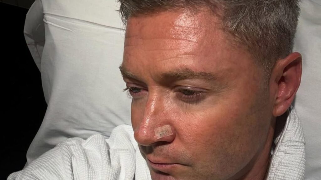 Michael Clarke, Australia's World Cup-winning captain, undergoes one more skin cancer surgery; shares photo