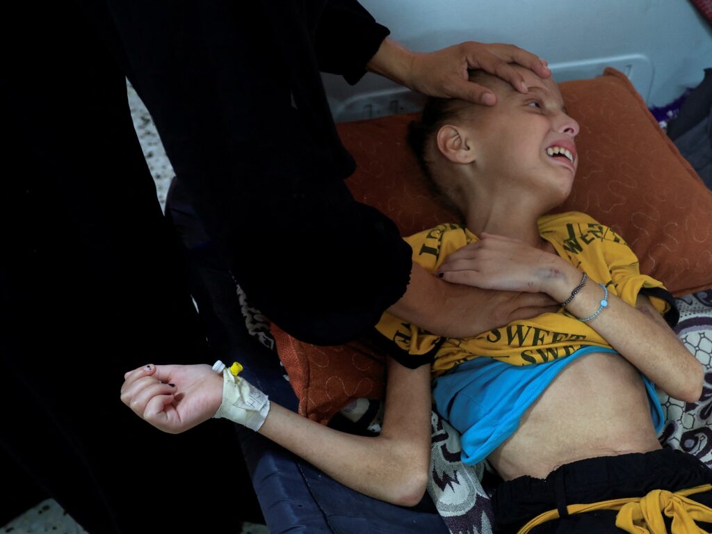Tens of thousands of Palestinian children starving in Gaza tent camps | Israel-Palestine conflict News
