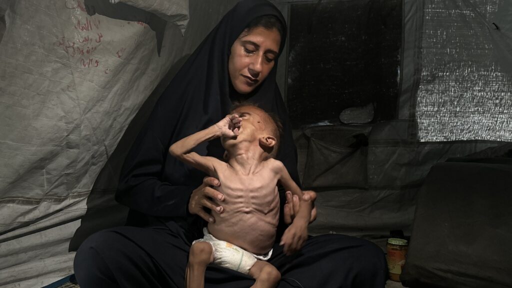 The Story Behind a Famous Photo of a Starving Child in Gaza