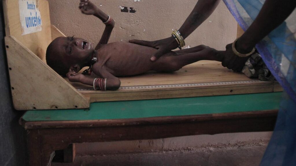 The complex web of factors behind India’s persistent stunting crisis