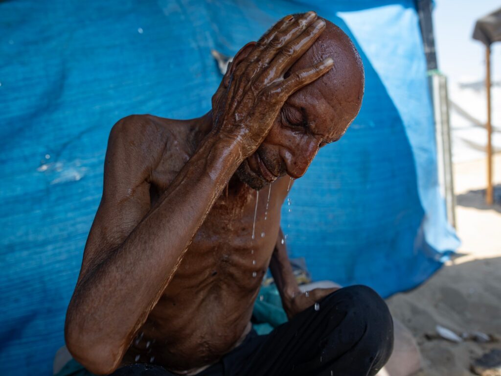 What ‘starvation’ really means, for the human body and for Gaza | Israel-Palestine conflict News
