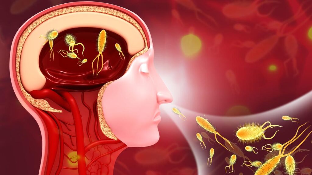 Amoebic meningoencephalitis: Ten things you need to know