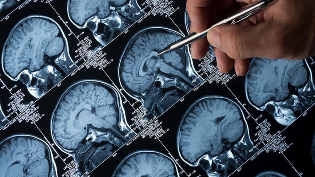 Brain-eating amoeba: Fourth recovery from amoebic meningoencephalitis reported in Kerala’s Kozhikode in recent weeks
