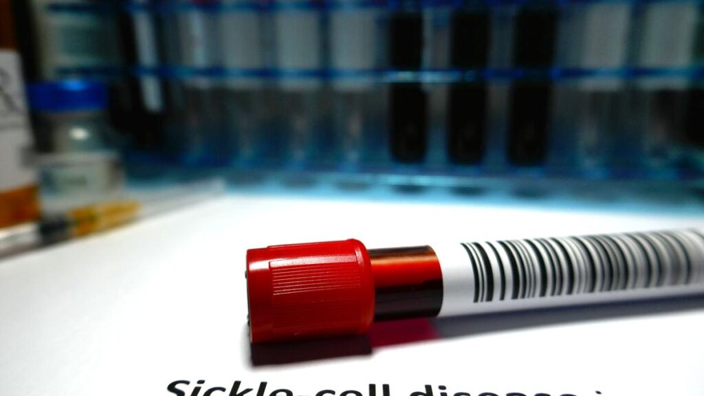 Sickle cell: The battle for disability justice