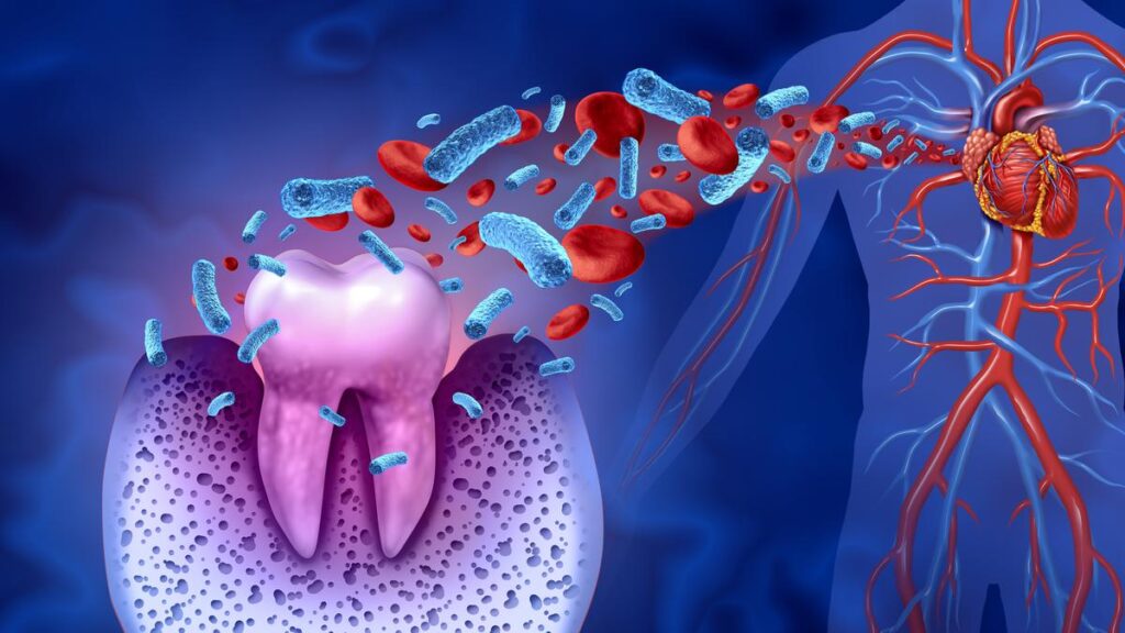 Could hidden dental bacteria help explain sudden and deadly heart attacks? Could hidden dental bacteria help explain sudden and deadly heart attacks?