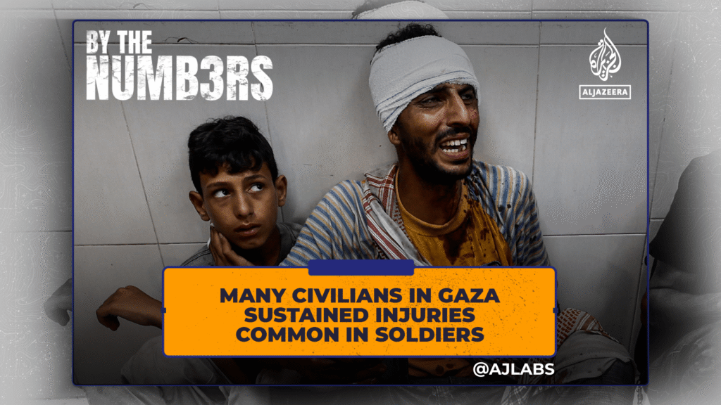 Many civilians in Gaza sustained injuries common in soldiers