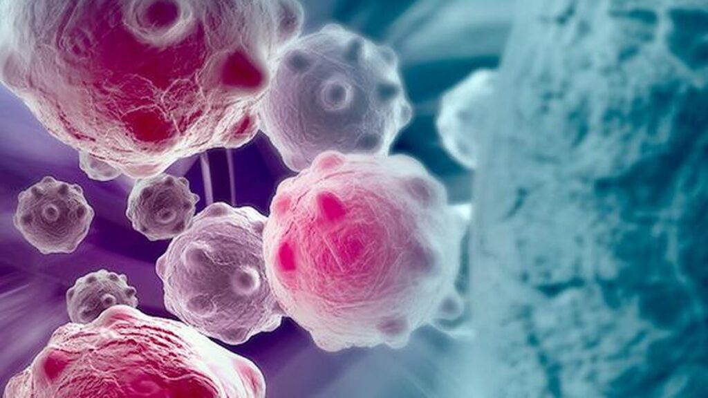 Study finds obesity-related cancer cases increasing in both young, older adults